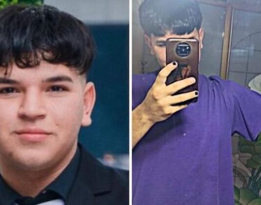 Jovencito de Empalme necesita cirugía reconstructiva