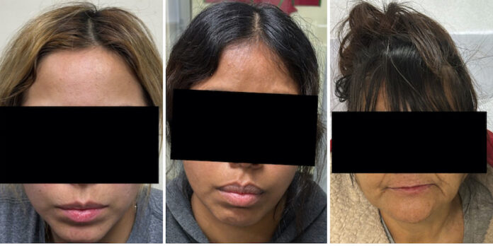 #SLRC Incautan pirotecnia y sustancias prohibidas en SLRC durante operativo de seguridad; tres mujeres fueron detenidas.