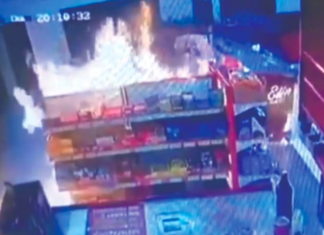 Niño de 2 años, con quemaduras en 87% de su cuerpo, lucha por su vida