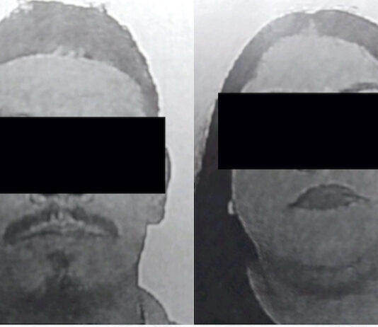 Pareja detenida por agresión en una casa de Trincheras