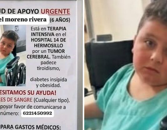 Niño empalmense lucha por su vida, tras operación de un tumor cerebral