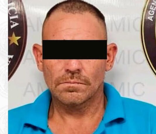 Joven de 27 años pierde la nariz y labio superior en ataque con machete